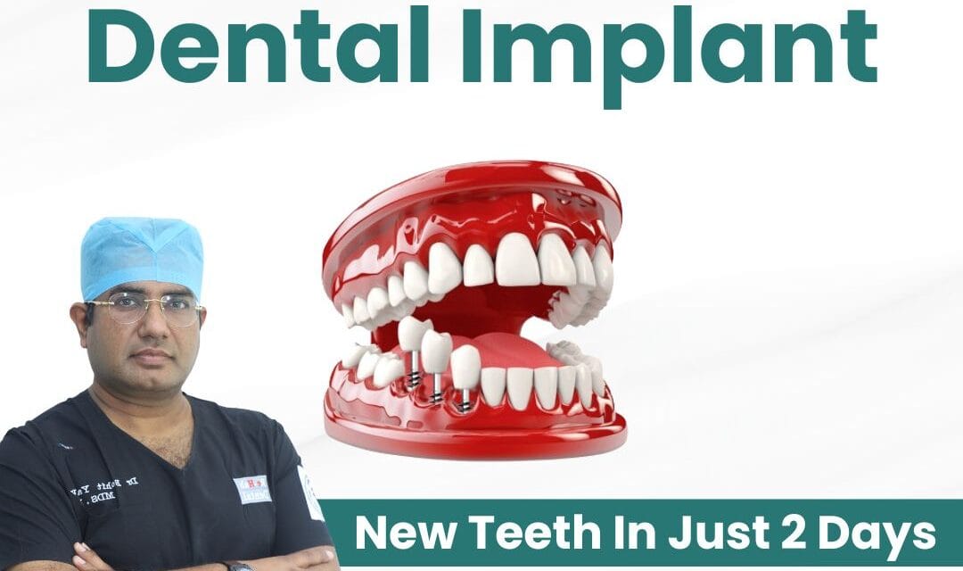 Affordable Teeth Replacement in India: The Cost-Effective Solution with Corticobasal® Implantology