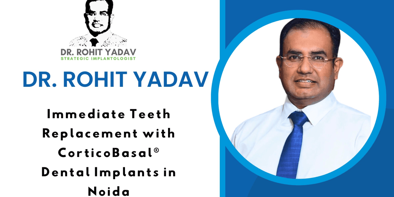 Immediate Teeth Replacement with CorticoBasal® Dental Implants in Noida