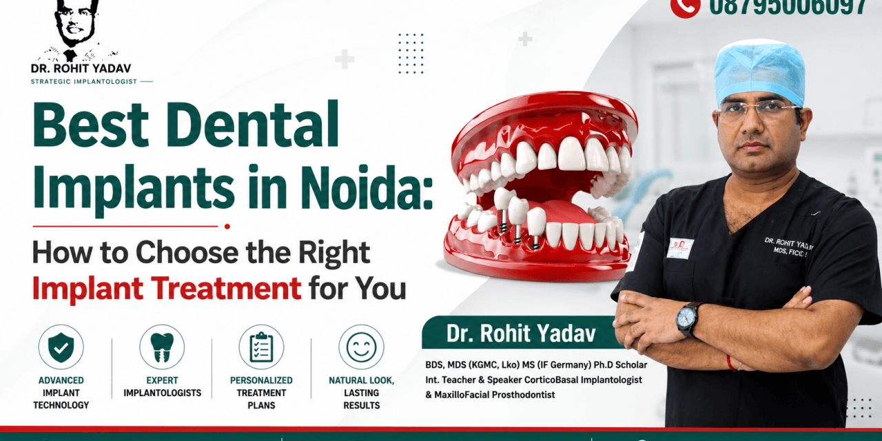 Best Dental Implants in Noida: How to Choose the Right Implant Treatment for You