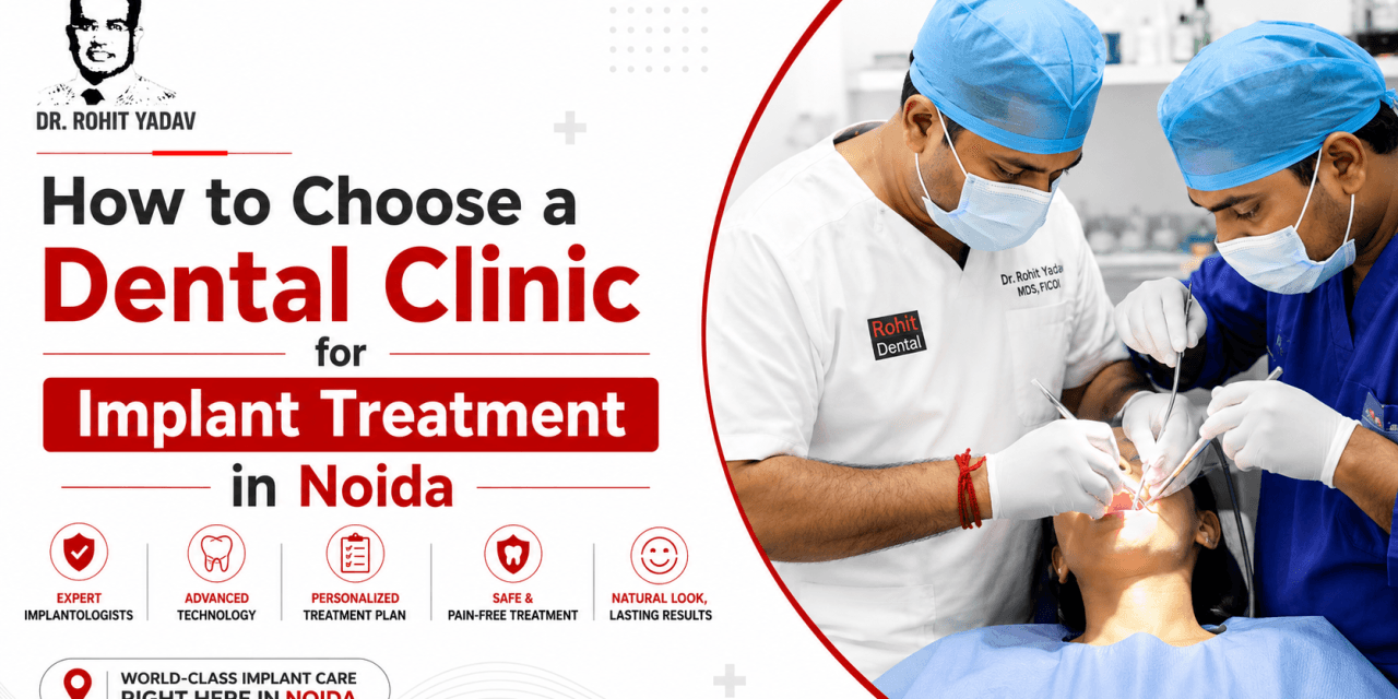 How to Choose a Dental Clinic for Implant Treatment in Noida