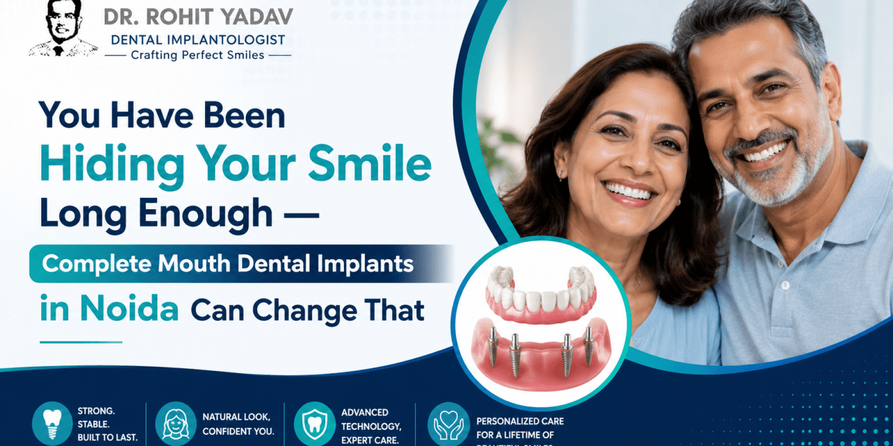 You Have Been Hiding Your Smile Long Enough — Complete Mouth Dental Implants in Noida Can Change That