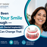 Complete Mouth Dental Implants in Noida