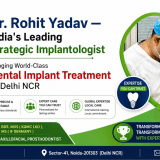 Dental Implant Specialist in India