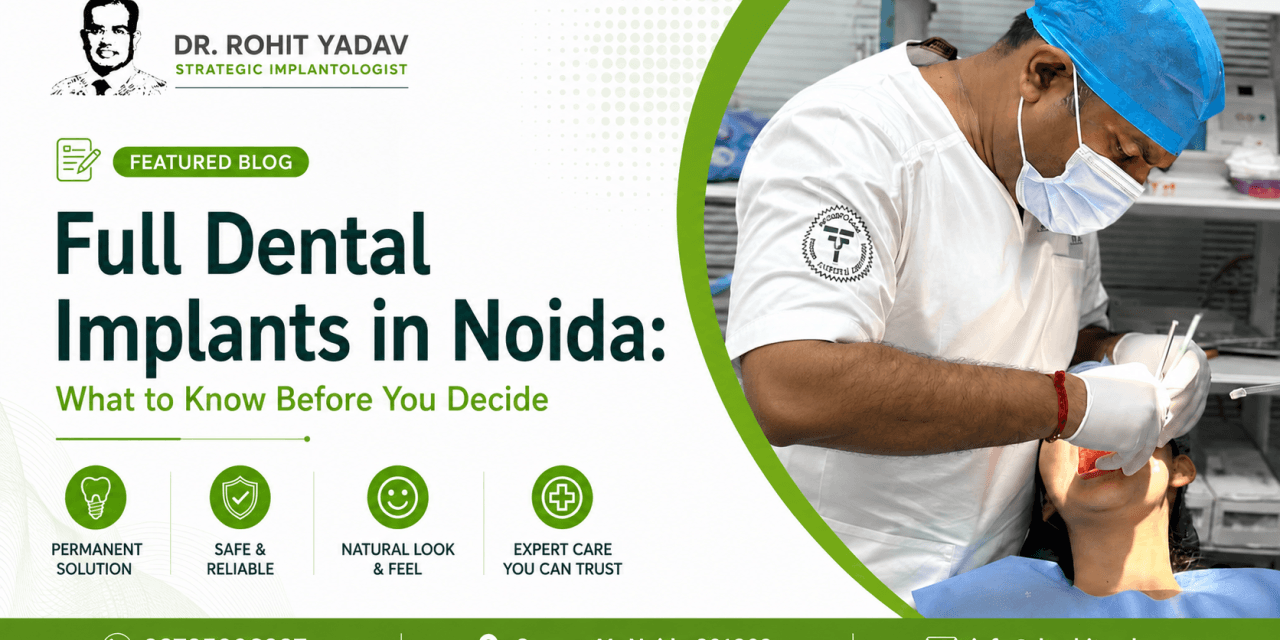 Full Dental Implants in Noida: What to Know Before You Decide