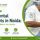 Full Dental Implants in Noida