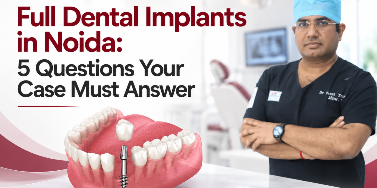 Full Dental Implants in Noida: 5 Questions Your Case Must Answer