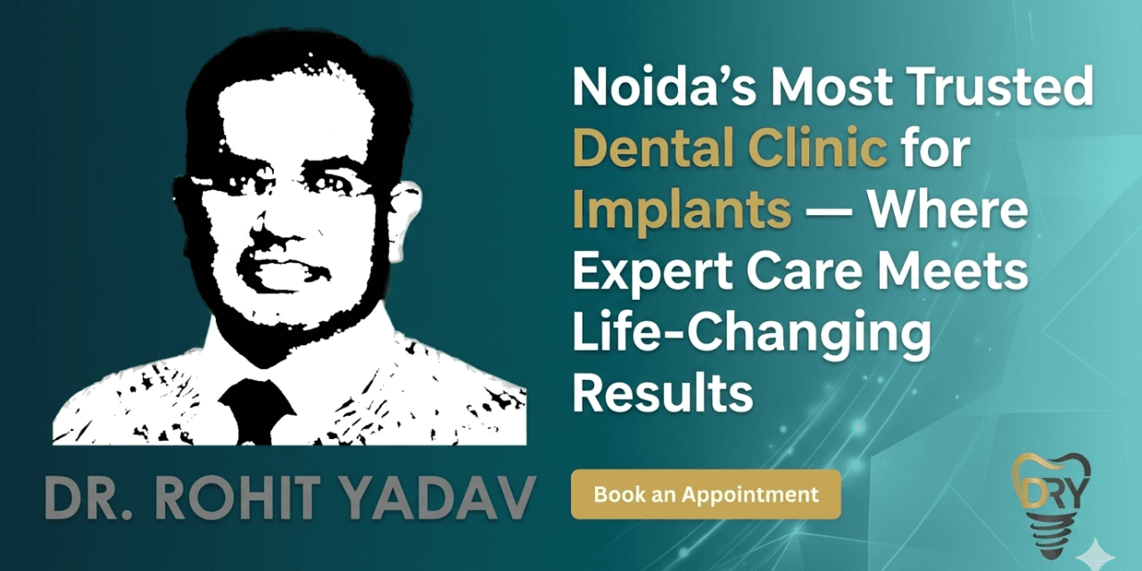 Noida’s Most Trusted Dental Clinic for Implants — Where Expert Care Meets Life-Changing Results
