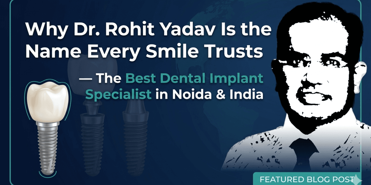Why Dr. Rohit Yadav Is the Name Every Smile Trusts — The Best Dental Implant Specialist in Noida & India