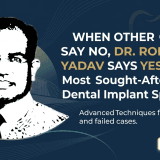 Dr Rohit Yadav implant surgeon in Noida