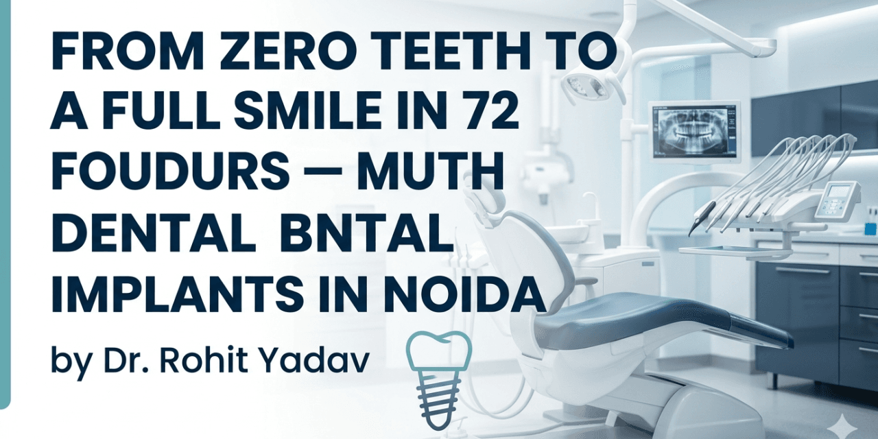 From Zero Teeth to a Full Smile in 72 Hours — Full Mouth Dental Implants in Noida by Dr. Rohit Yadav