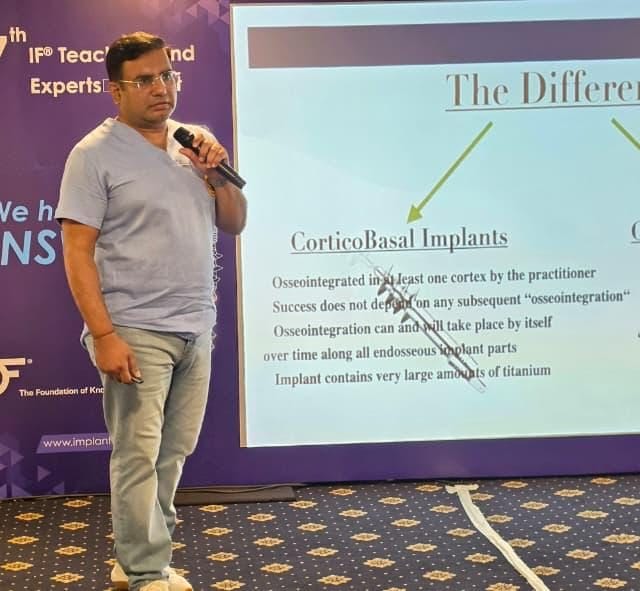 Rohit Yadav Dentist & Corticobasal Implantologist, Noida