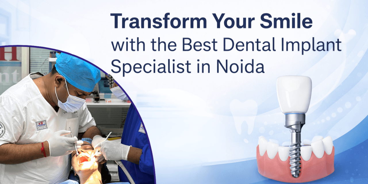 Transform Your Smile with the Best Dental Implant Specialist in Noida