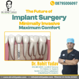 Best dental implant oral surgery