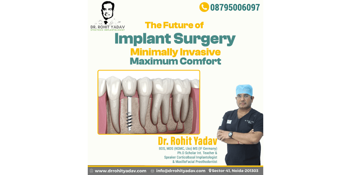 Expert Oral and Implant Surgeons: Transforming Smiles with Precision and Care