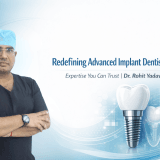 best dental implantologist in Noida
