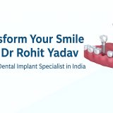 Best Dental Implant Specialist in India