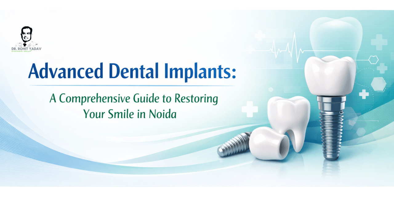 Advanced Dental Implants: A Comprehensive Guide to Restoring Your Smile in Noida