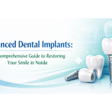 Full mouth dental implants surgeon India