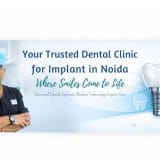 Best dental implant clinic in Noida
