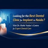 Best dental implant clinic in Noida