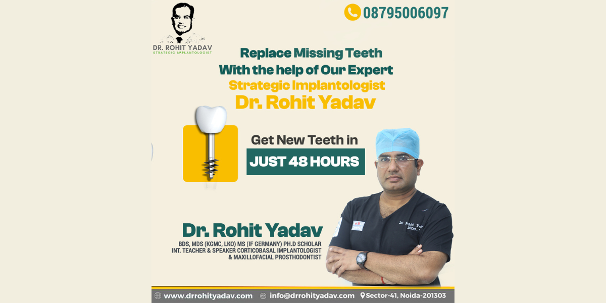 Dr. Rohit Yadav – The Leading Dental Implantologist in India for Superior Dental Care