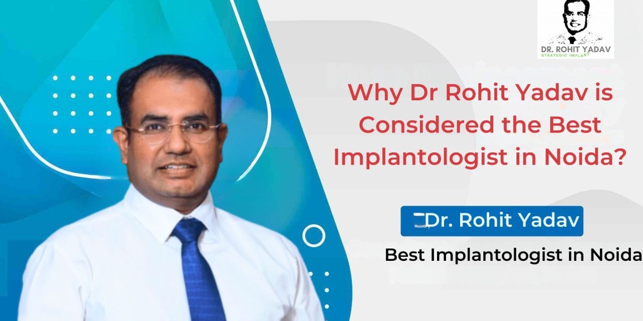 Why Dr Rohit Yadav is Considered the Best Implantologist in Noida?