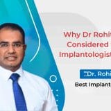 Best Implantologist in Noida