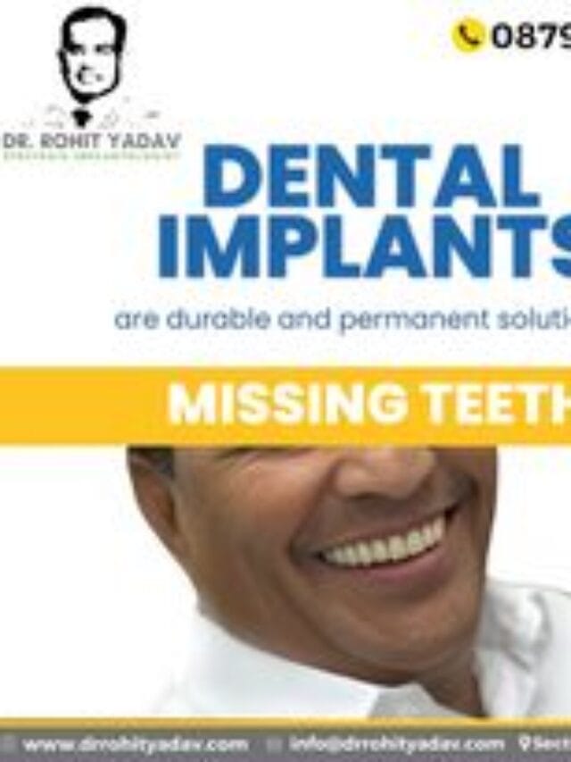 Dentures vs Dental Implants