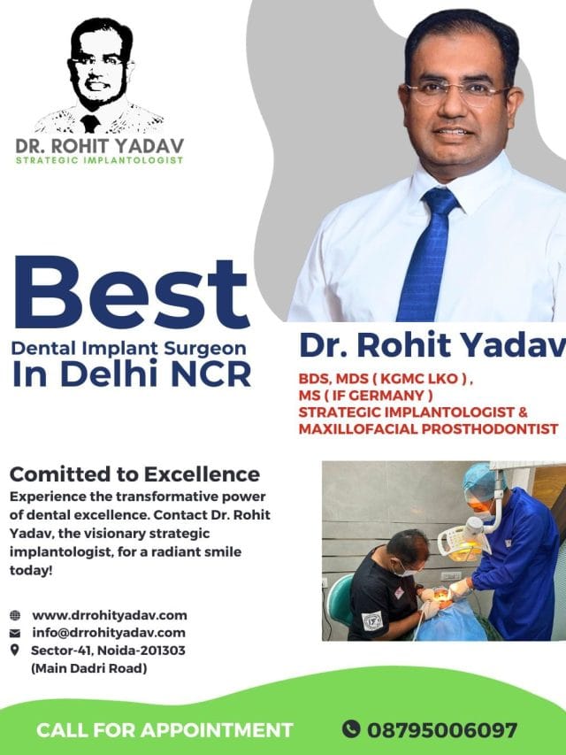 Immediate loading dental implants