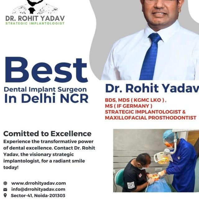 Best Dental Implant Surgeon In Delhi NCR