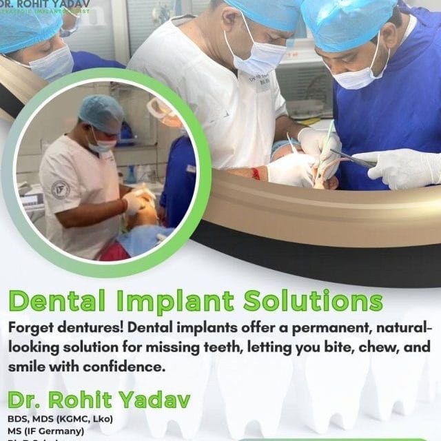 Immediate Functional Loading by Dr. Rohit Yadav