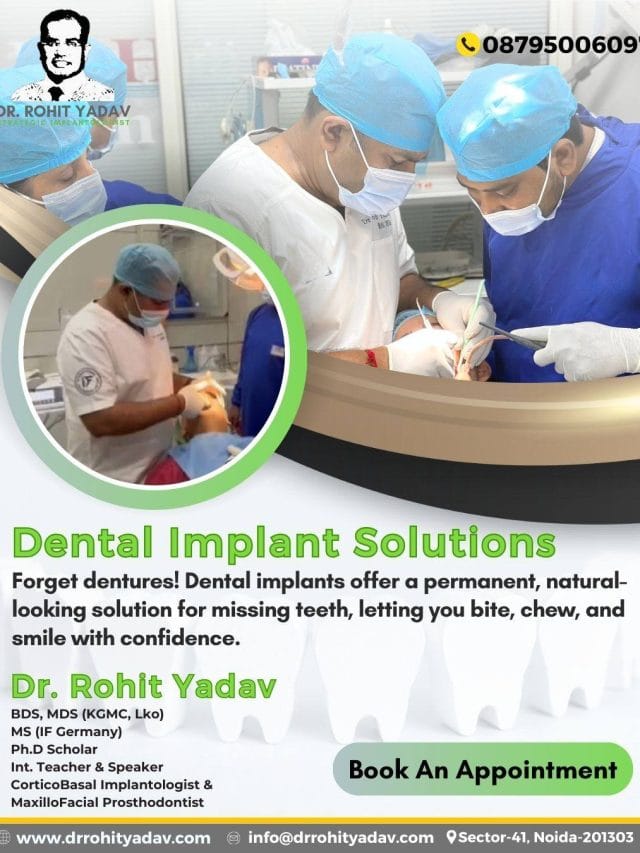 Corticobasal implants