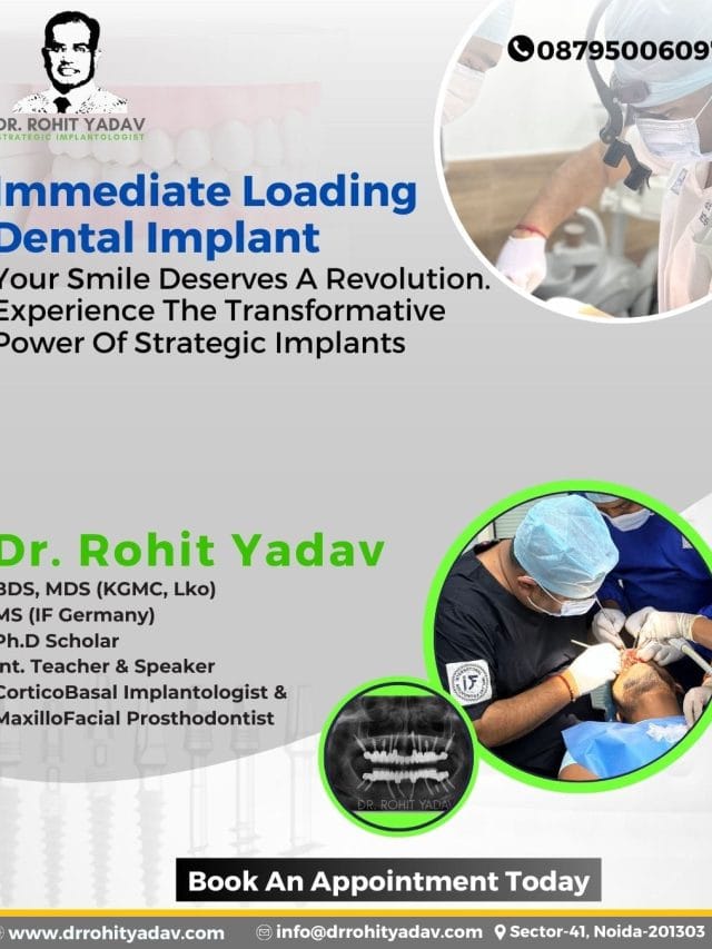 Best Dental Implants Clinic