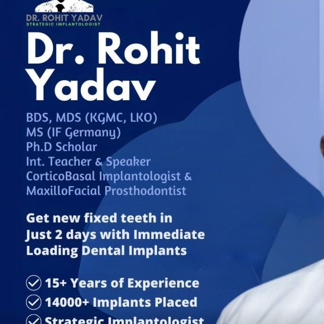 Dr. Rohit Yadav Best Dental Implant