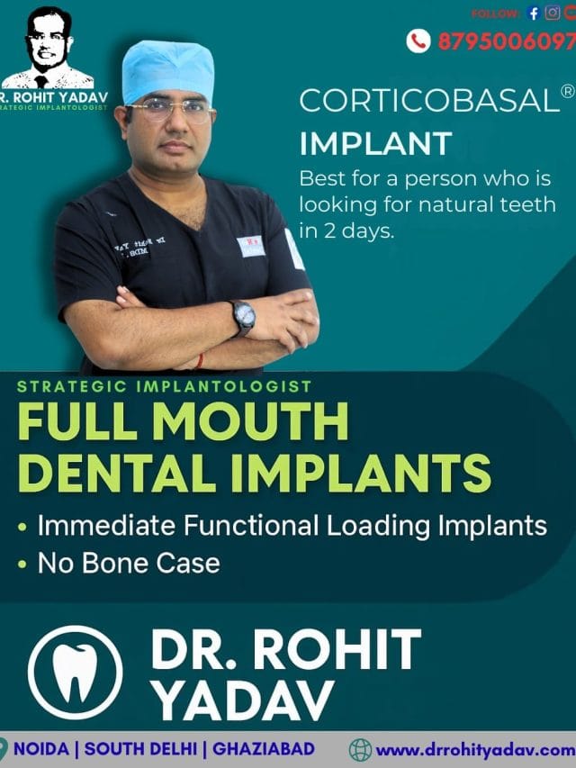 Corticobasal Implant Solutions
