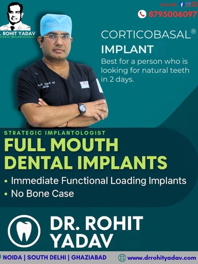 Corticobasal® Implant