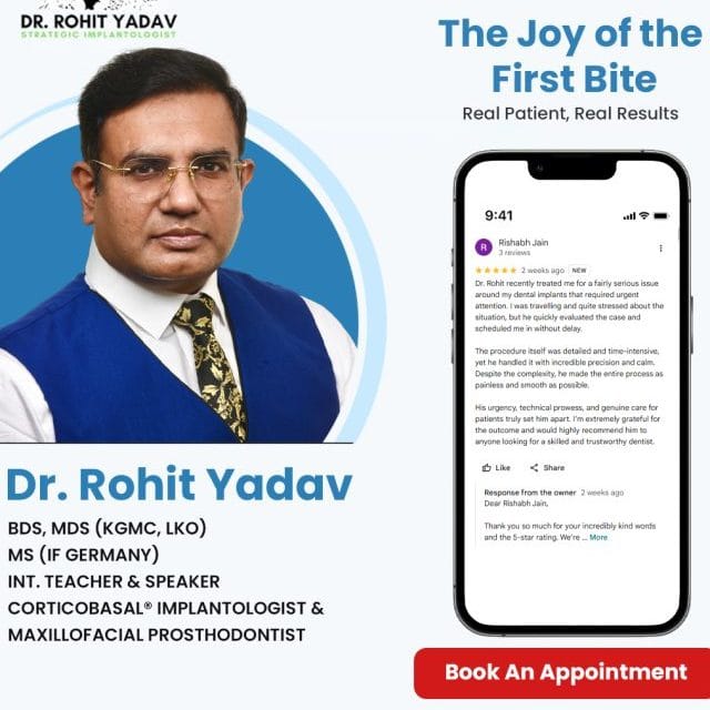 Best Dental Implants By Dr Rohit Yadav