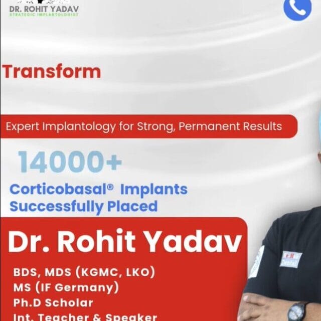Permanent Tooth Replacement by Dr. Rohit Yadav