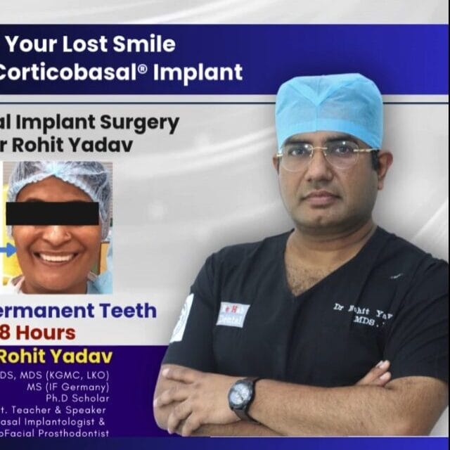 Fixed teeth with strategic implants in India