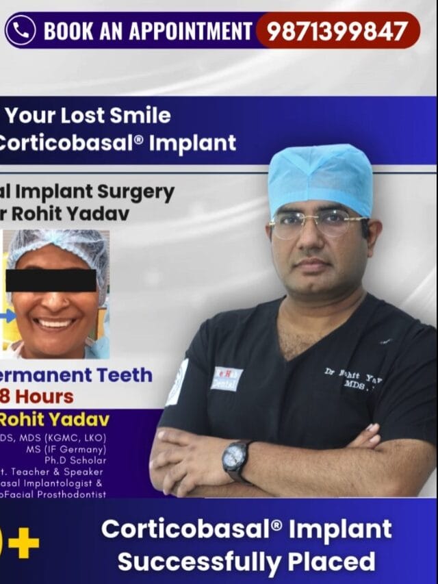 Fixed teeth with strategic implants in India